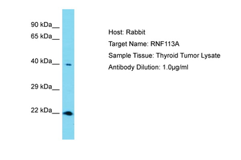 RNF113A Rabbit Polyclonal Antibody