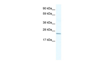 CRIP2 Rabbit Polyclonal Antibody