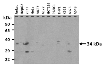 ZFP36 Rabbit Polyclonal Antibody