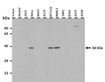 ZFP36 Rabbit Polyclonal Antibody
