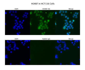 HOXB7 Rabbit Polyclonal Antibody