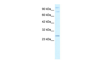 PCGF3 Rabbit Polyclonal Antibody