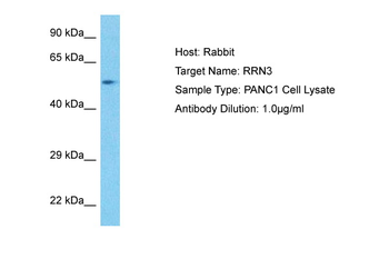 RRN3 Rabbit Polyclonal Antibody