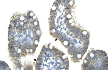 ZNF498 Rabbit Polyclonal Antibody