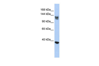 SMARCA1 Rabbit Polyclonal Antibody