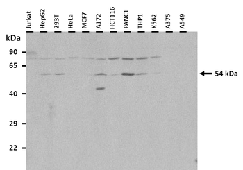 NRF1 Rabbit Polyclonal Antibody
