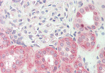 KLHL25 Rabbit Polyclonal Antibody