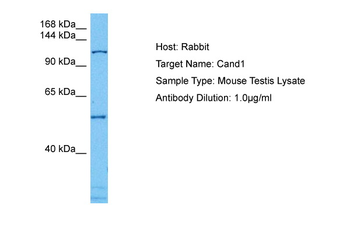TIP120A Rabbit Polyclonal Antibody