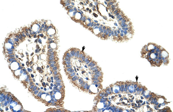 DMTF1 Rabbit Polyclonal Antibody