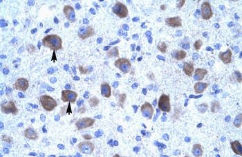 KCNIP4 Rabbit Polyclonal Antibody
