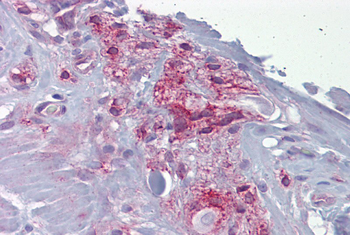ASPH Rabbit Polyclonal Antibody