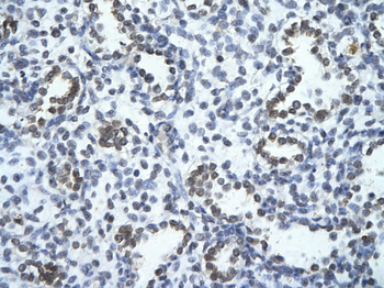 JADE1 Rabbit Polyclonal Antibody