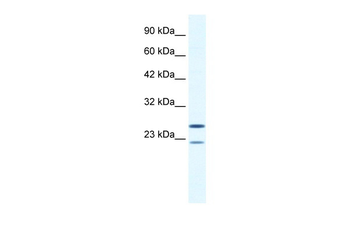 TRIM14 Rabbit Polyclonal Antibody