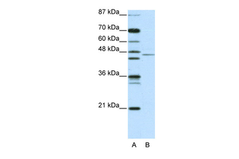 TRIM14 Rabbit Polyclonal Antibody