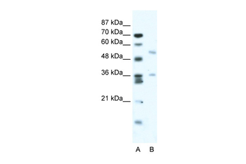 BTBD3 Rabbit Polyclonal Antibody