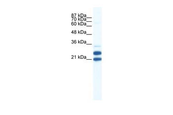 TRIM34 Rabbit Polyclonal Antibody