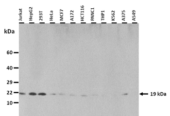 CNBP Rabbit Polyclonal Antibody