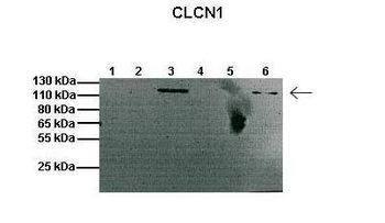 Clcn1 Rabbit Polyclonal Antibody