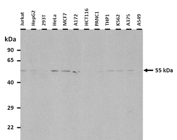 GABRA3 Rabbit Polyclonal Antibody