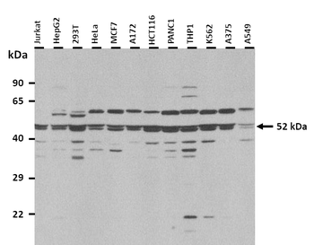 GABRA5 Rabbit Polyclonal Antibody