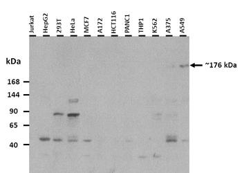SHROOM2 Rabbit Polyclonal Antibody