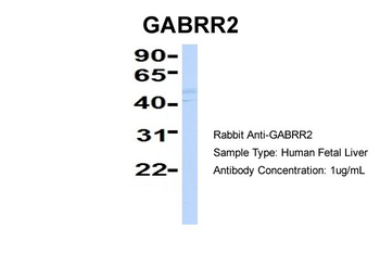 GABRR2 Rabbit Polyclonal Antibody