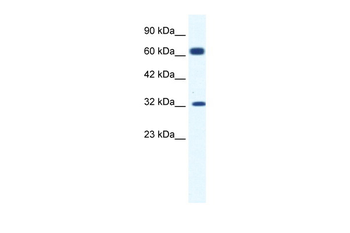 KCNN1 Rabbit Polyclonal Antibody