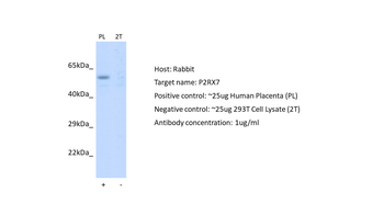 P2RX7 Rabbit Polyclonal Antibody