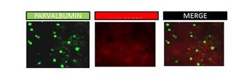 KCNAB1 Rabbit Polyclonal Antibody