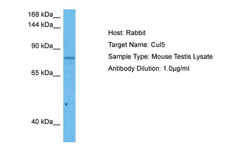 CUL5 Rabbit Polyclonal Antibody