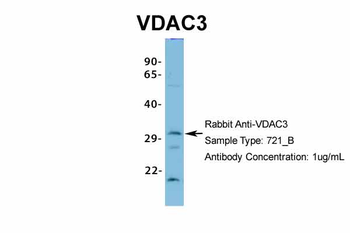 VDAC3 Rabbit Polyclonal Antibody