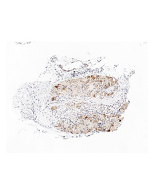 TRPA1 Rabbit Polyclonal Antibody