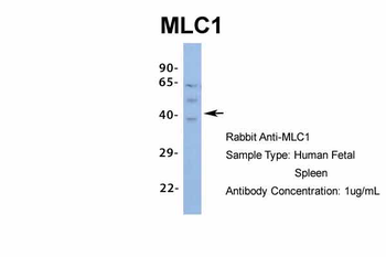 MLC1 Rabbit Polyclonal Antibody