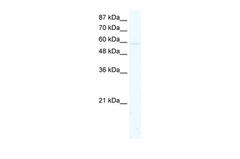 KCNK10 Rabbit Polyclonal Antibody