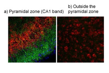 TRPV4 Rabbit Polyclonal Antibody