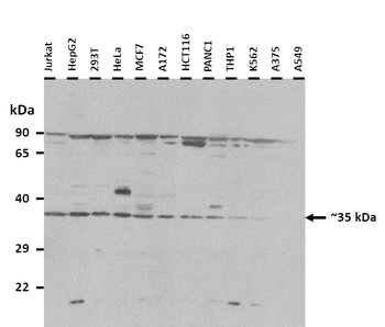 KCTD10 Rabbit Polyclonal Antibody