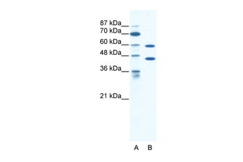 CATSPER2 Rabbit Polyclonal Antibody