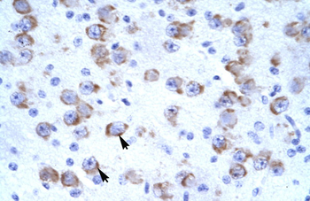 CATSPER2 Rabbit Polyclonal Antibody