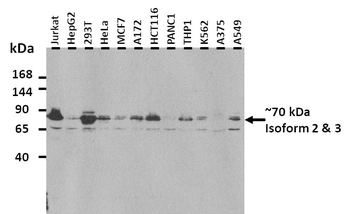 KCNH5 Rabbit Polyclonal Antibody
