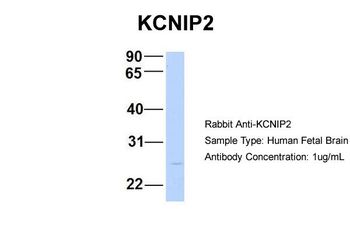 KCNIP2 Rabbit Polyclonal Antibody