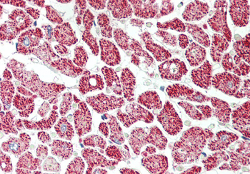 KCNIP2 Rabbit Polyclonal Antibody