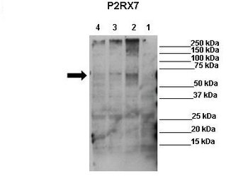 P2RX7 Rabbit Polyclonal Antibody