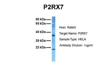 P2RX7 Rabbit Polyclonal Antibody