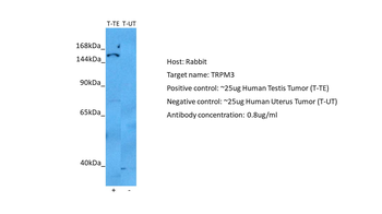 TRPM3 Rabbit Polyclonal Antibody