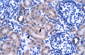 ZNF134 Rabbit Polyclonal Antibody