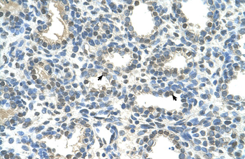 HOXC9 Rabbit Polyclonal Antibody