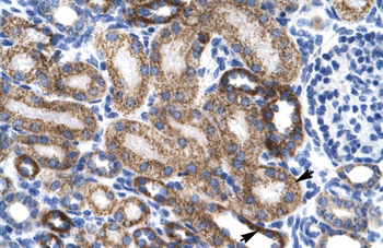 ZNF75 Rabbit Polyclonal Antibody