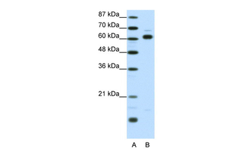TRIP4 Rabbit Polyclonal Antibody