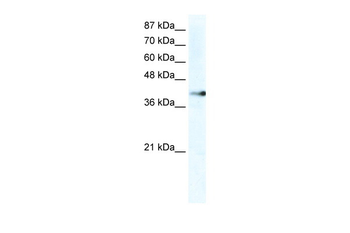 ZNF556 Rabbit Polyclonal Antibody