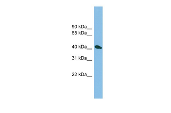ZNF514 Rabbit Polyclonal Antibody